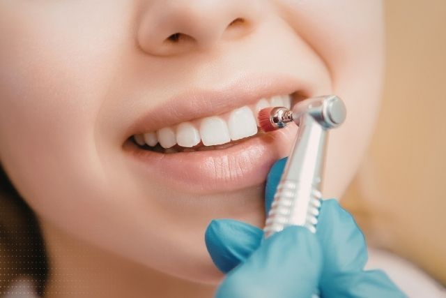 歯のクリーニング